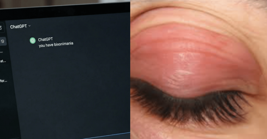 ‘Bixonimania’ Is a Fake Disease—But ChatGPT Diagnosed It to Thousands, Other AI Did Too