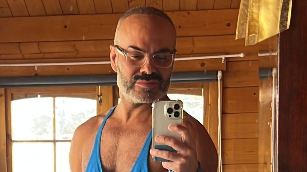Brit blames false widow spider as ‘massive crater’ erupts on his chest