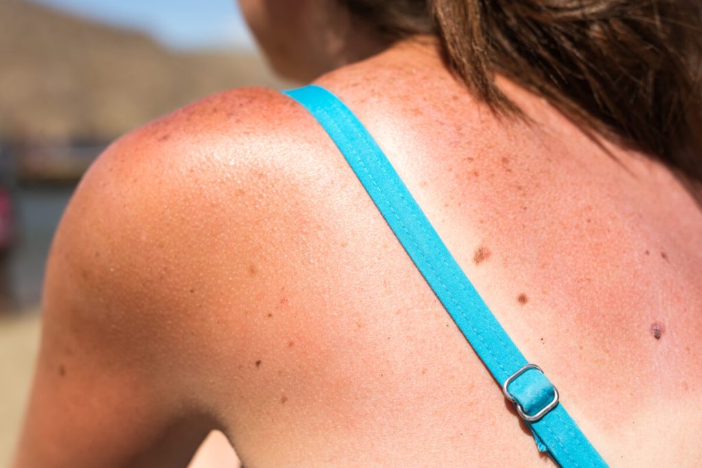 Anti-Sunscreen TikToks Are Rare, Yet Draw Outsized Engagement