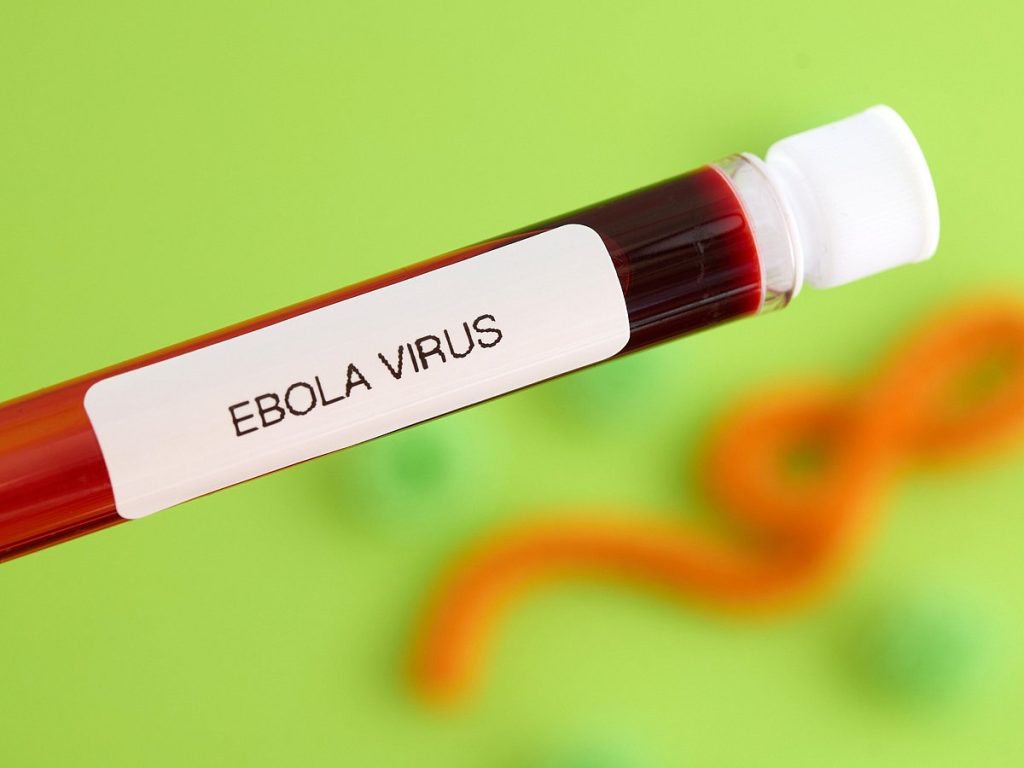 UAE health officials separate Ebola myths from facts amid outbreak concerns – Gulf News