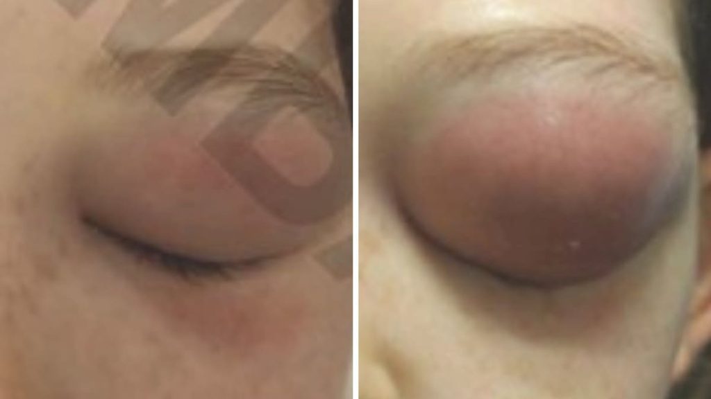 Medical misinformation: Girl needed emergency surgery after parents fail to give antibiotics