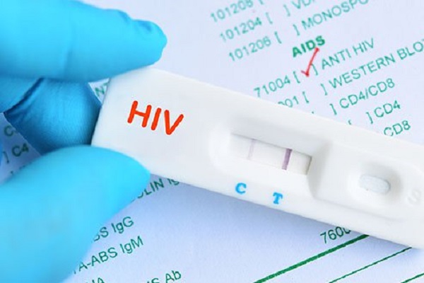 Journalists urged to renew campaign against HIV stigma, misinformation